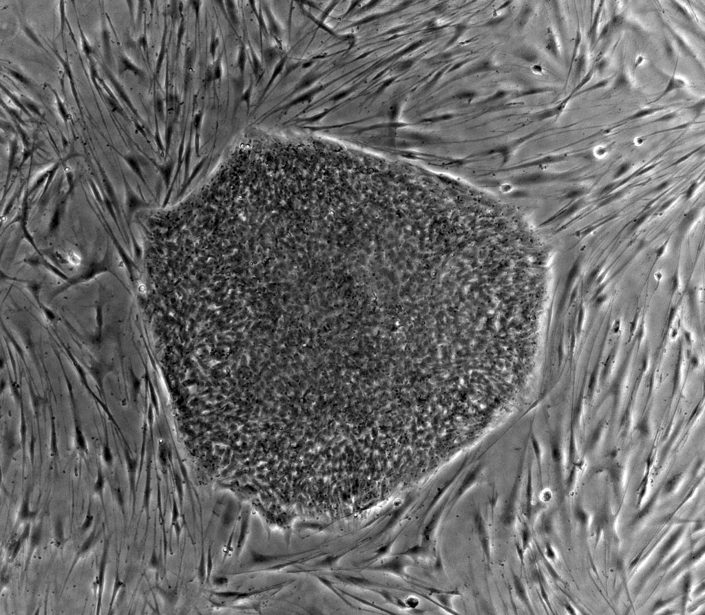 Yamanaka’s “Rewind” Button for Cells