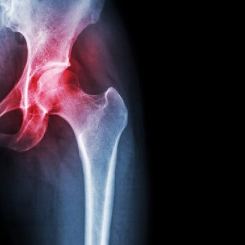 Researchers find method to regrow cartilage in the joints Researchers find method to regrow cartilage in the joints