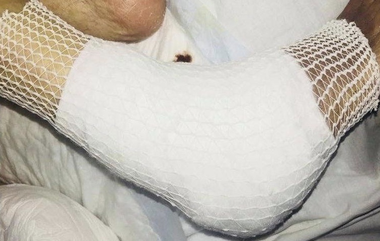 Tratamente la domiciliu - Pansamente - Tratarea ranilor - Ce comprese si fesi cuprinde 👉 TRUSA mea MEDICALA ?