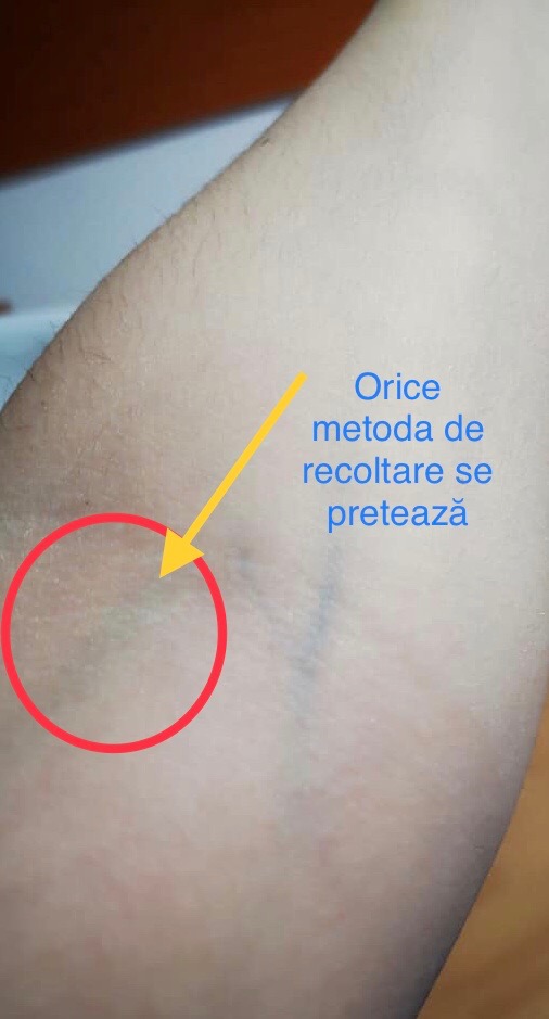 Administrarea intravenoasa - Recoltarea sangelui - Cum si de ce facem alegerea venelor in punctia venoasa?