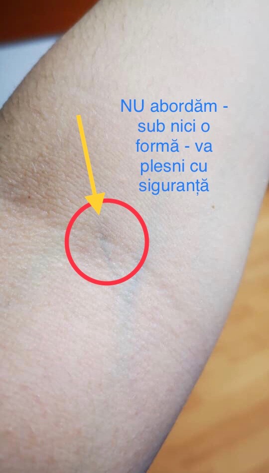 Administrarea intravenoasa - Recoltarea sangelui - Cum si de ce facem alegerea venelor in punctia venoasa?