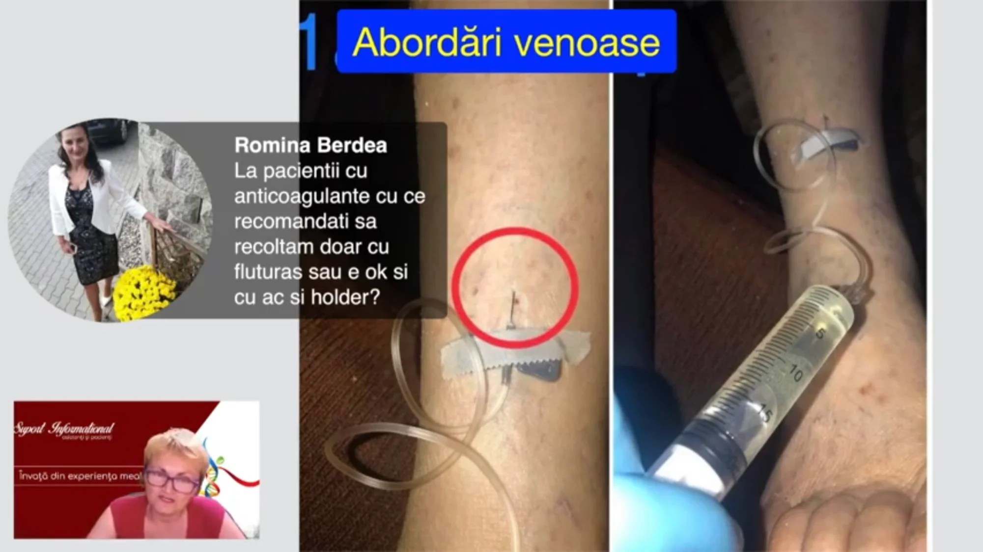 Punctia venoasa - Tratamente la domiciliu - Analize medicale - Analize de sange - Cum fac recoltarea sangelui la pacientii cu anticoagulante?