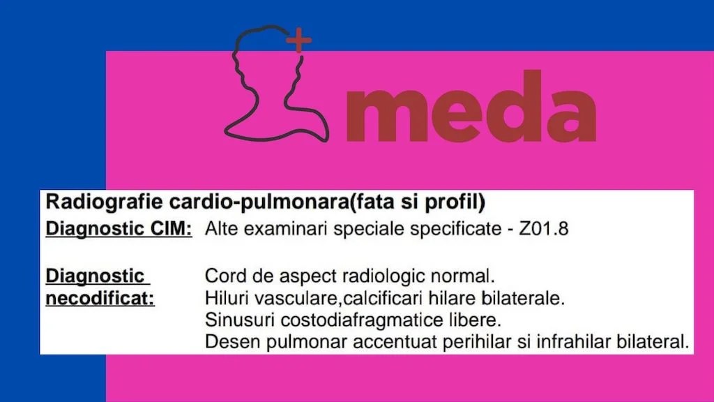 Interpretare radiografie pulmonara 👉 Calcificari HILARE - Rx pulmonar