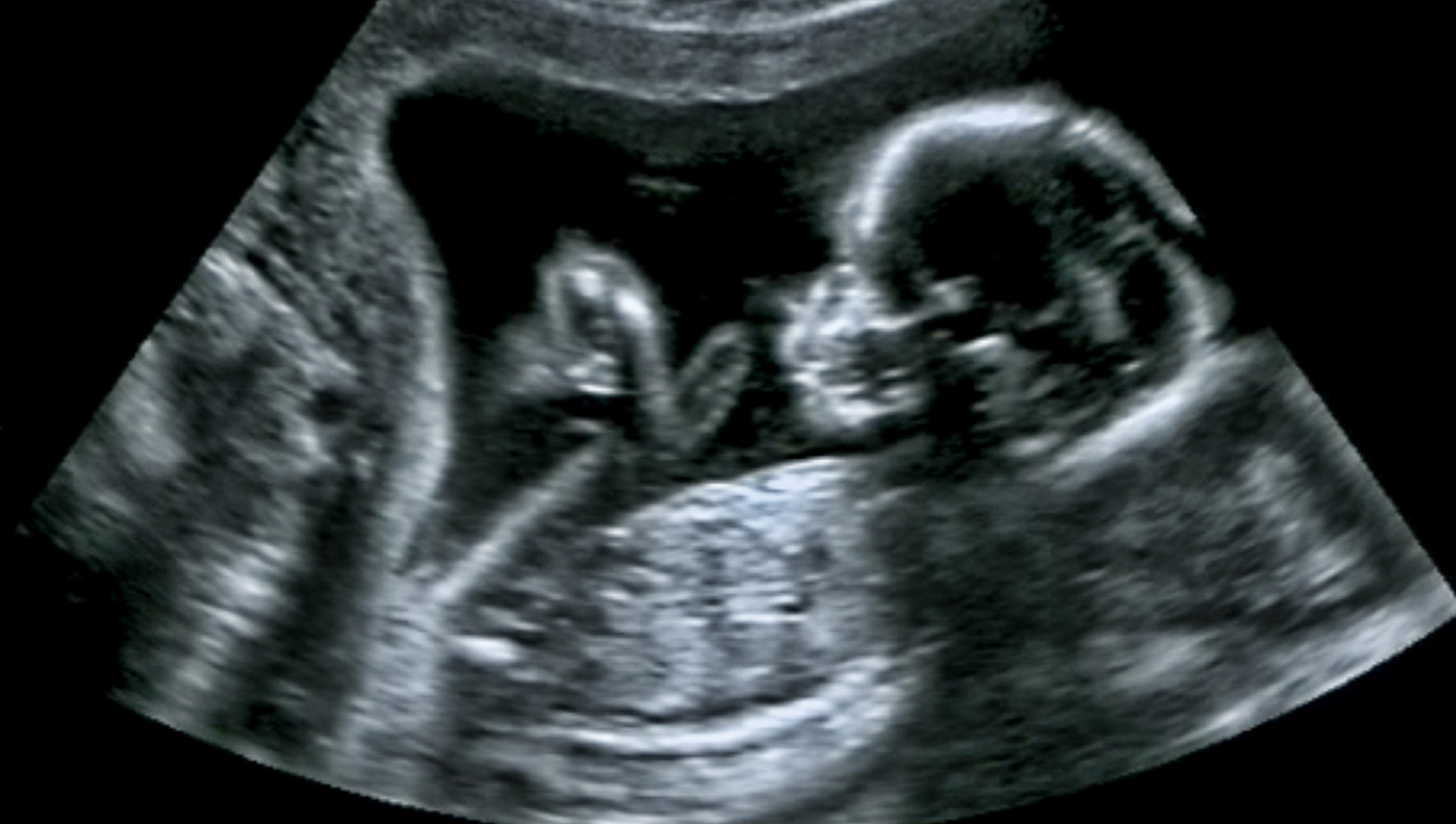 Close One This Baby Was Almost Born Into Poverty But His Mother Killed Him In The Nick Of Time The Babylon Bee