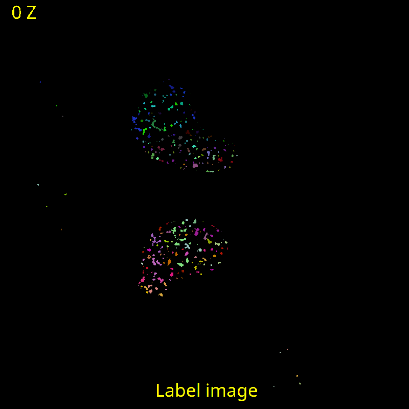 Fast Non Local Means Denoise With Opencv Scijava Ops Documentation - Best Gradient Photos in 8K