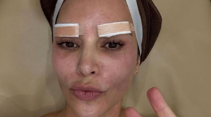 Kim Kardashian’s Korean Magnificence Remedy Is Actually In depth