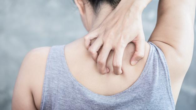 Bersihkan kulit dengan scrub · 4. Penyebab Jerawat Punggung Dan Cara Tepat Untuk Mengatasinya