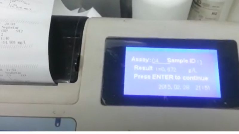 Complement C3 Blood Test C3 Test Complement C3 Blood Test For Sle - Premium City Texture Gallery - 8K