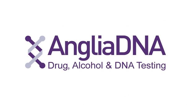 https://i0.wp.com/medilabghana.com/wp-content/uploads/2022/04/ANGLIA-DNA-UK.jpeg?fit=615%2C340&ssl=1