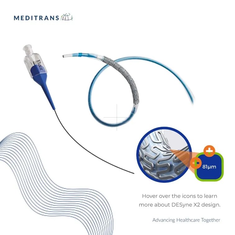 Keunggulan Drug-Eluting Stent Generasi Terbaru: Elixir Medical Desyne X2
