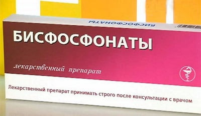 Яка хвороба – остеопороз.  Остеопороз - що це за хвороба, причини та симптоми