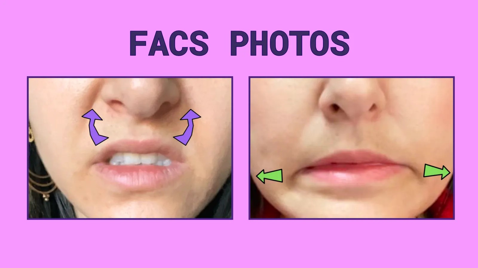 diagram of FACS upper lip raiser and lip stretcher