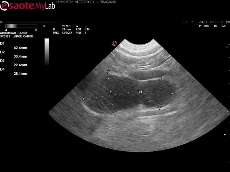Intraabdominal lymphadenopathy, hemoptysis, and melena in a 7 yr old