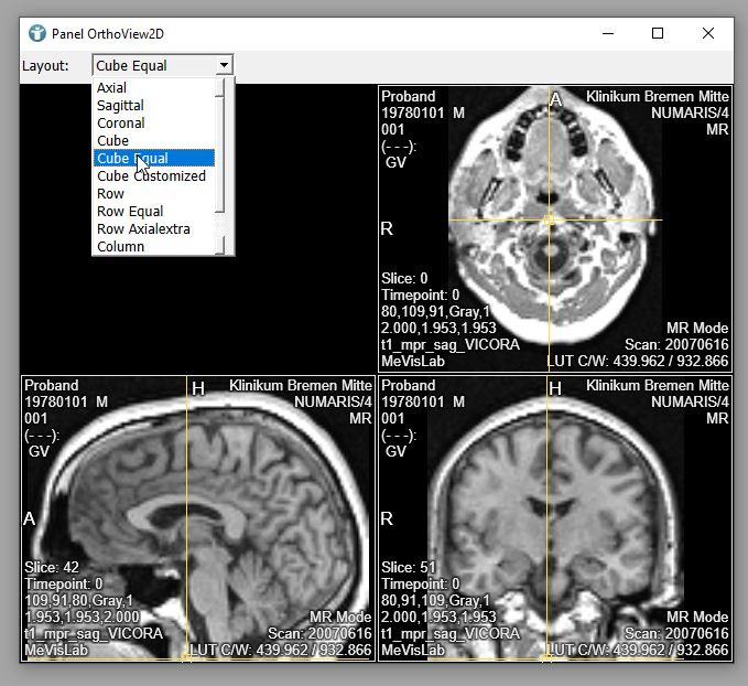 A2 Getting Orthofinder Input Data Orthofinder Tutorials - Sunset Designs - Classic Full HD Collection