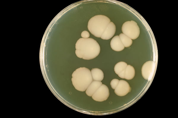 Инфекционные болезни характеризуются следующими особенностями. Основные признаки инфекционных болезней: этиологический, эпидемиологический, клинические и их характеристика