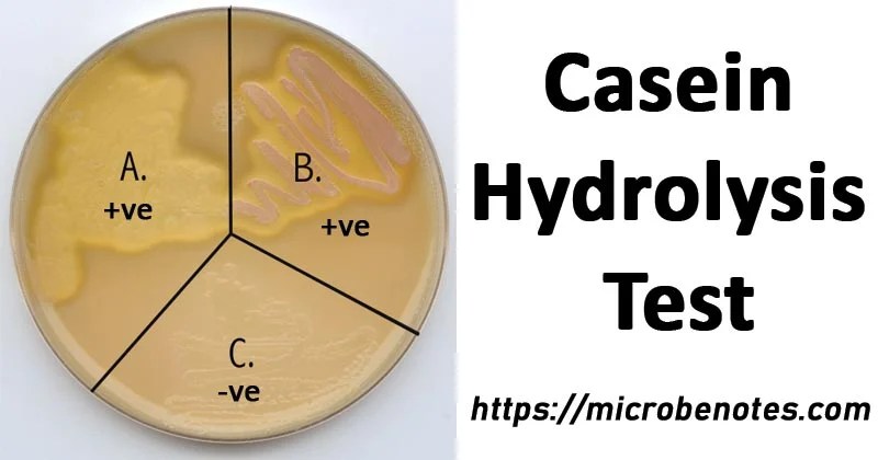 The Zone Of Hydrolysis Produced Bacterial Strains On Nutrient Agar Download Scientific Diagram 6This alkaline reaction can be demonstrated in urea agar containing the pH indicator phenol red.