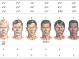 Polygenic Inheritance Definition Characteristics Examples