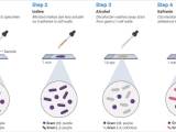 Staining Notes Microbe Notes