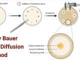Kirby Bauer Disc Diffusion Method For Antibiotic Susceptibility Testing
