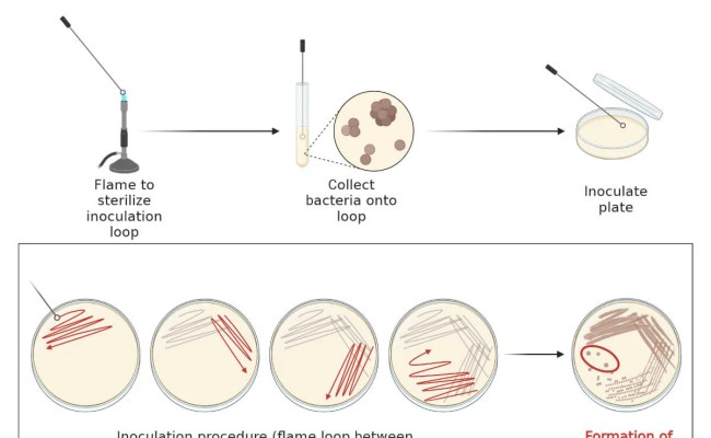 Streak Plate Method- Principle, Types, Methods, Uses, 46% OFF