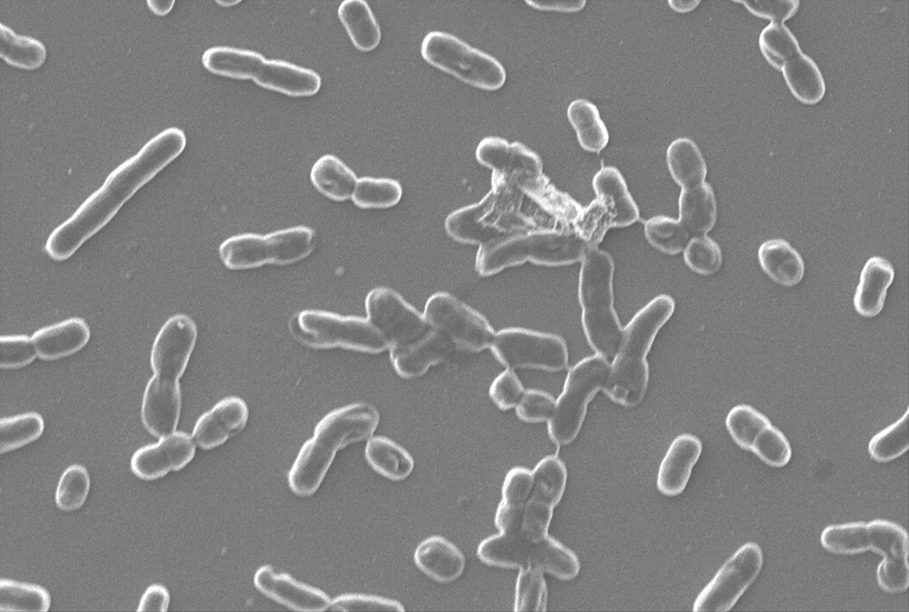 Scanning electrons microscopy of Acinetobacter baumannii after exposure to Bald's eyesalve.