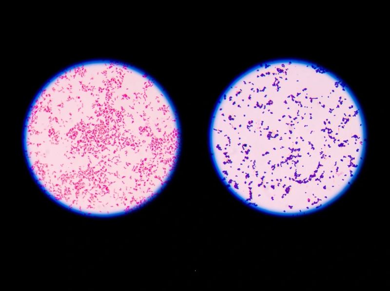 Solution Types Of Microbial Staining Studypool - Classic Full HD Gradient Patterns | Free Download