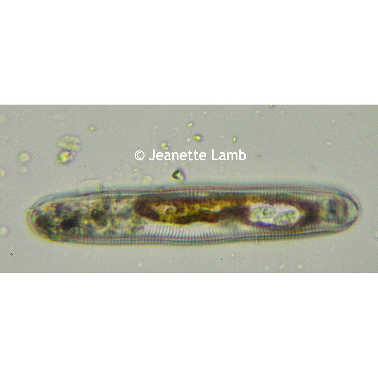 Microscopy Pond Water Critters | Microbus Microscope Educational Website