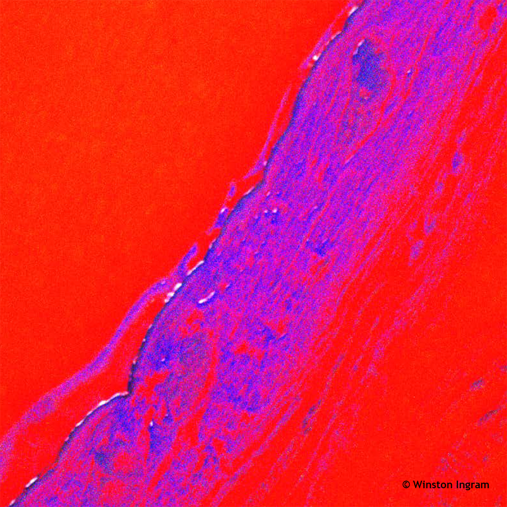 Skin Section