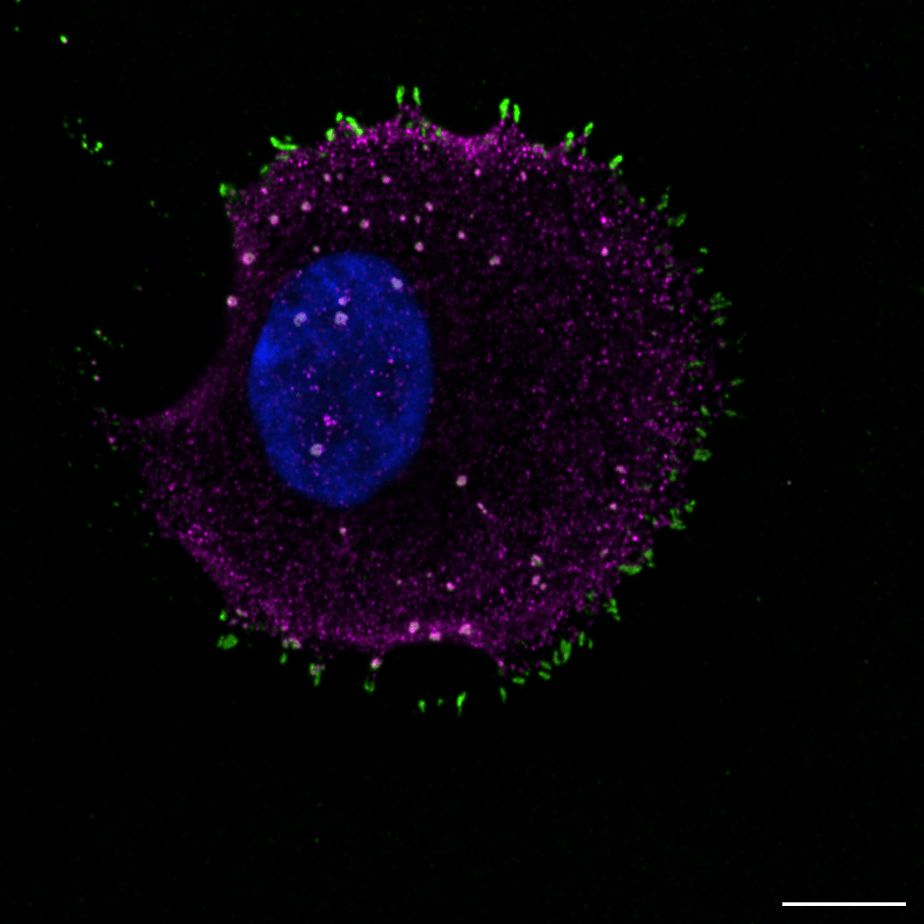 Reticular focal adhesions