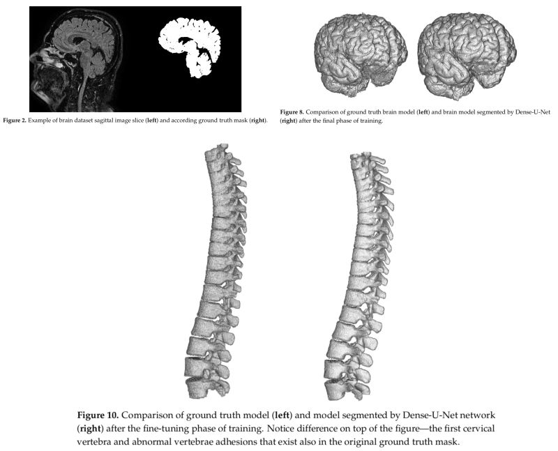 3d Dense U Net 3d Dense U Net - Premium Nature Illustration Gallery - Retina