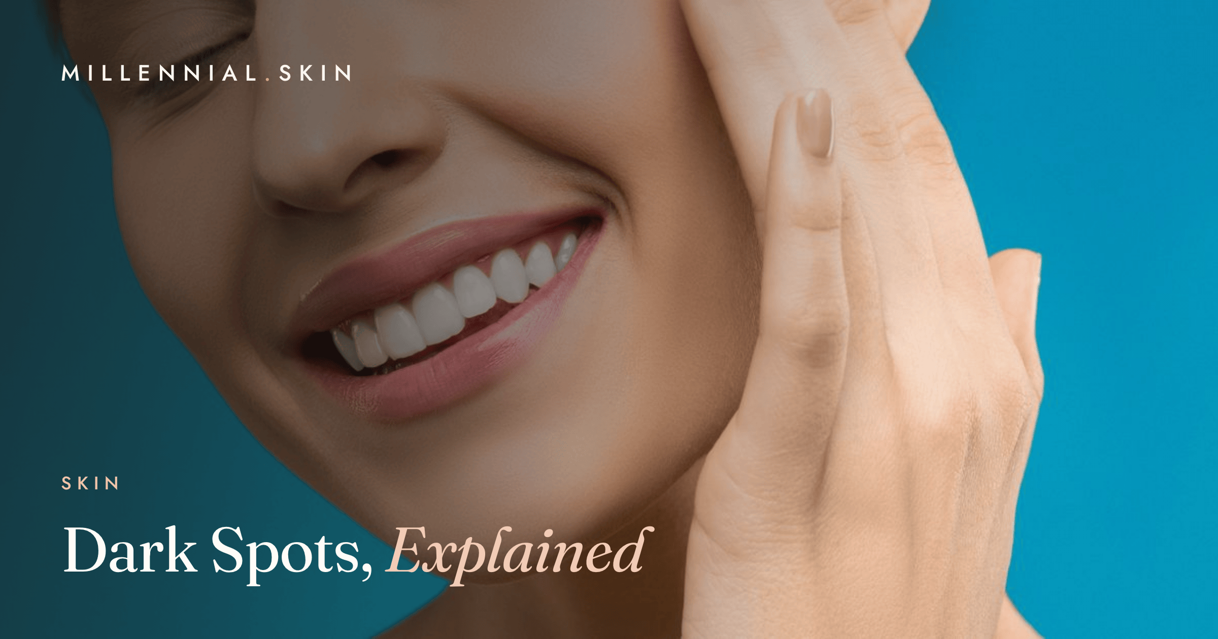 Dark Spots and Hyperpigmentation: The Complete Guide
