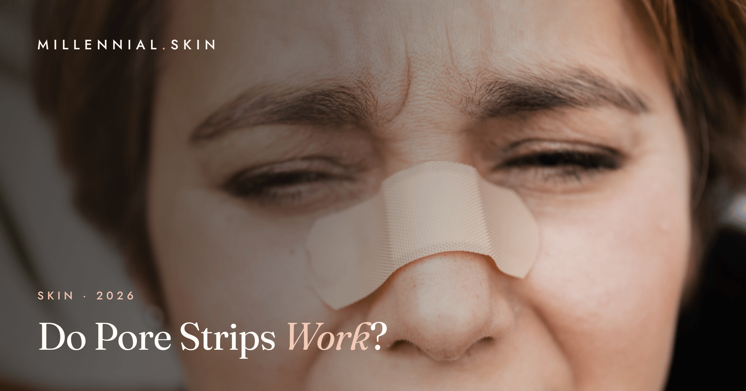 Do Pore Strips Actually Work? What to Know Before You Use Them in 2026