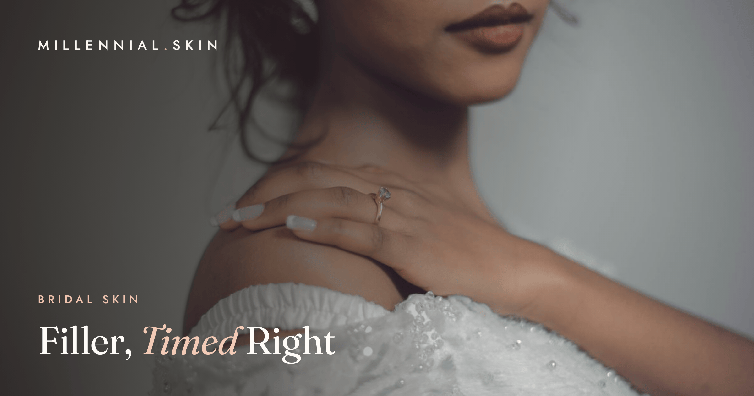Filler Before Your Wedding: Timing, Swelling and What to Skip