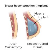 Technologies Ushering a New Age in Breast Cancer Screening