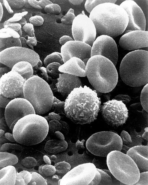 A scanning electron microscope image of normal circulating human blood. In addition to the irregularly shaped leukocytes, red blood cells and many small disc-shaped platelets are visible. The image is in black and white.