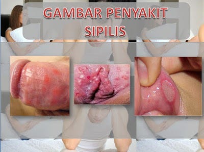 Info Obat Alat Vital Luka Daerah Jakarta Wirdatul Jannah Medium