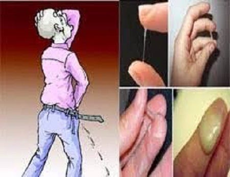 Obat Sipilis Pengobatan Penyakit Kelamin Pria Wanita Medium