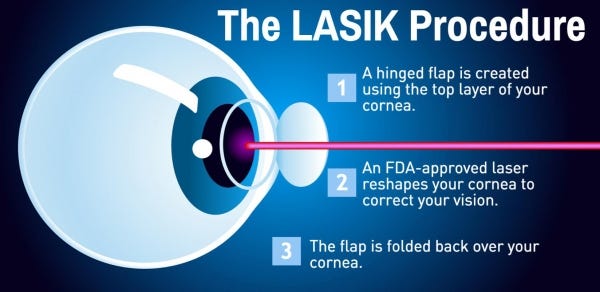 pic Lasik Eye Surgery Before And After Vision medium