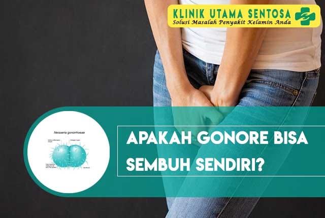 Apakah Gonore Bisa Sembuh Sendiri? Begini Penjelasannya | by dsh harso | Medium