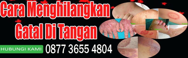 Cara Menghilangkan Gatal Di Tangan Enal Cdf Medium