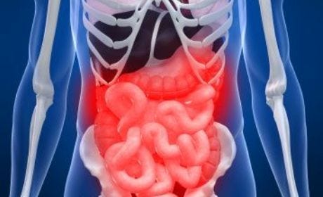 45 Cara Mengatasi Perut Melilit Dan Muntah Karena Masuk Angin