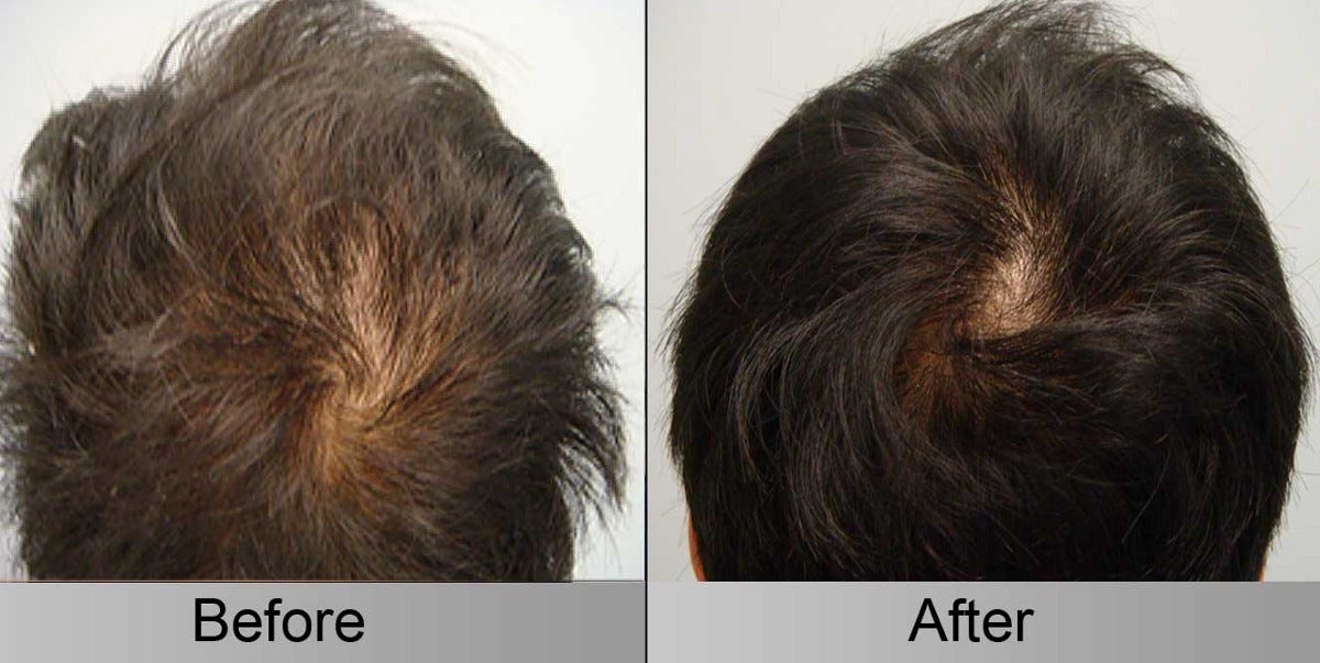 How to grow hair faster?. mr. rohit’s hairdresser was complaining…
