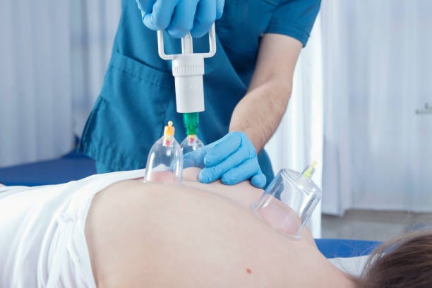 Unlock healing secrets: cupping therapy in riyadh