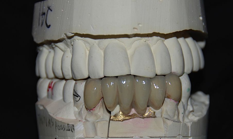 Team up with a computer partner against opponents to test your skills in this great version of the classic card game. MDS | Crowns & Bridges