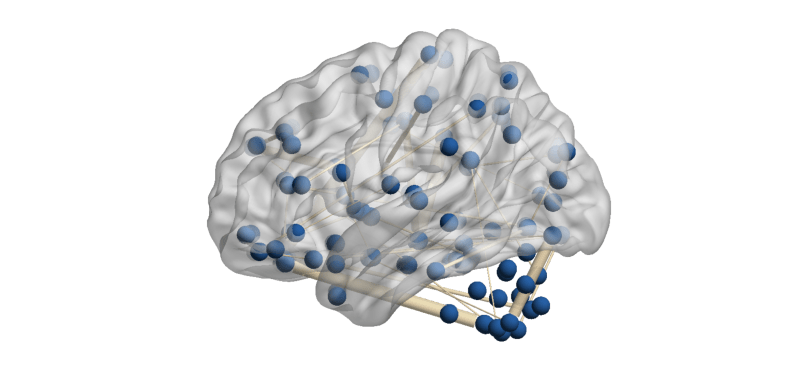 Functional Mri Data Cca Pls Toolkit - Elegant Retina Light Textures | Free Download