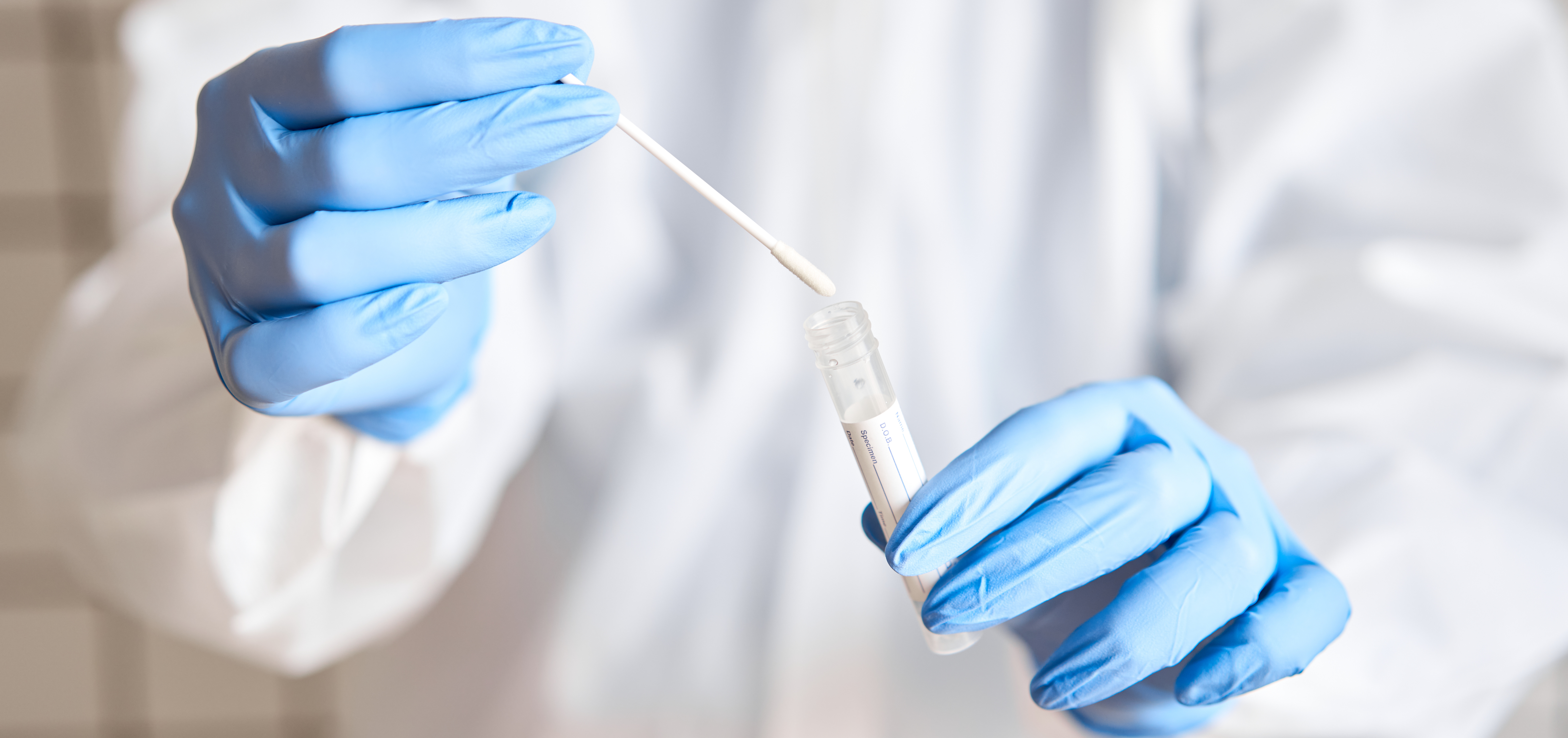 Yale COVID-19 test is a breakthrough for MLW and sports