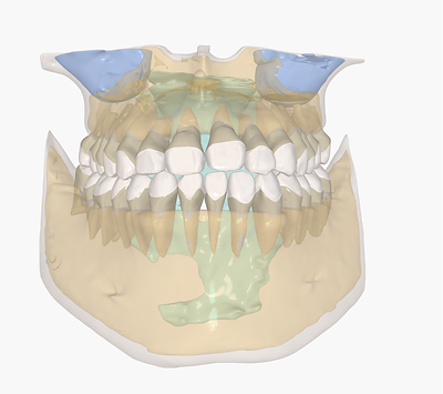 IRS (Intelligent Root System) Gold provides detailed 3D visualizations of cortical and cancellous bone, maxillary sinus, and airway structures for more comprehensive case evaluation