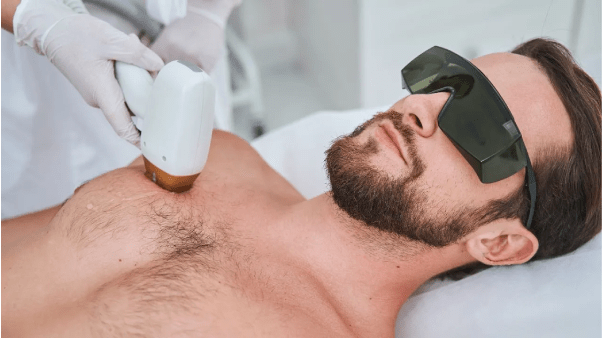Laser hair removal Surrey BC treatment for smoother skin and reduced razor burn