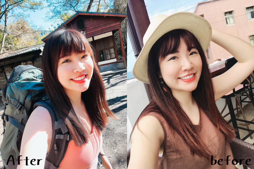 全新無痛音波拉提！渦旋音波不敷麻藥真的不會痛！拉提鬆弛垮垮臉@捷運雙連站(美麗晶華診所)