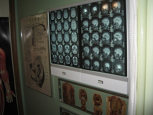 Xray Xray